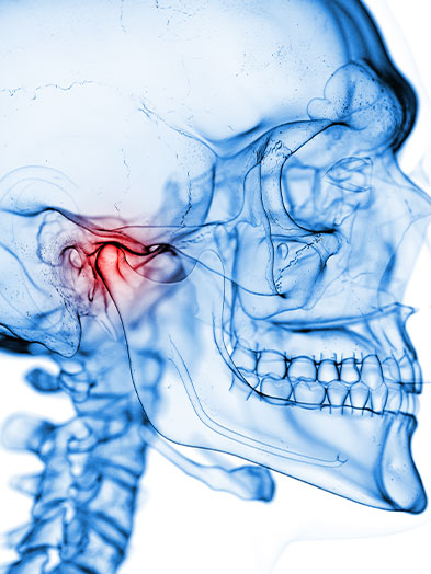 tmj disorder